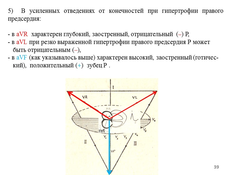 39 5) В усиленных отведениях от конечностей при гипертрофии правого предсердия: 39 5) В усиленных отведениях от конечностей при гипертрофии правого предсердия: